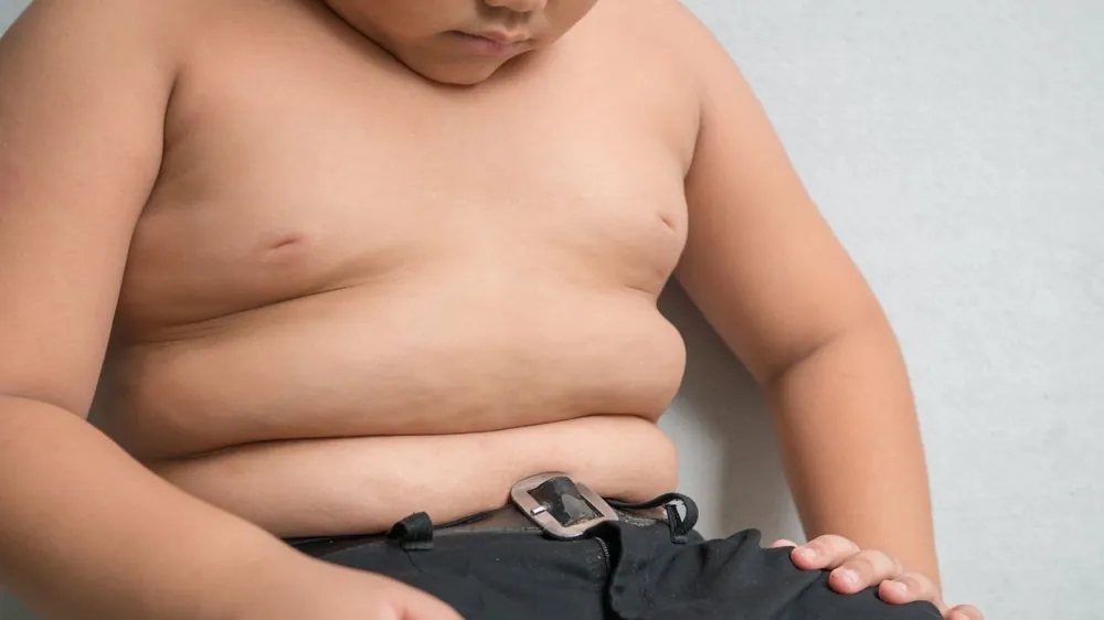 Body Mass Index Among Children and Adolescents During the COVID-19