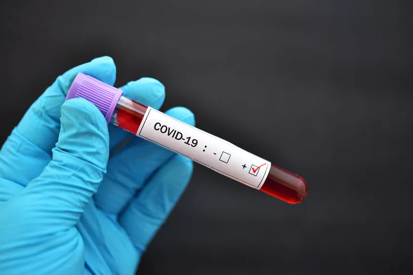Stanford Team Finds Evidence COVID-19 Mortality Rate As Low as .2% (17 x Lower Than WHO Estimate)