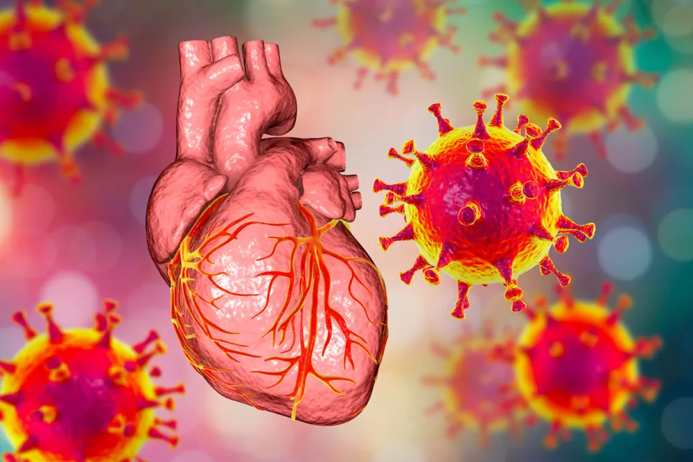 New Peer-Reviewed Study: COVID-19 Vaccines Increase Risk of Cardiac Arrest in Young People by 25 Percent