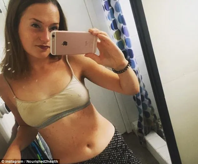 Waitress Overcomes Psoriasis After Adopting a Vegan, Gluten-Free Diet 