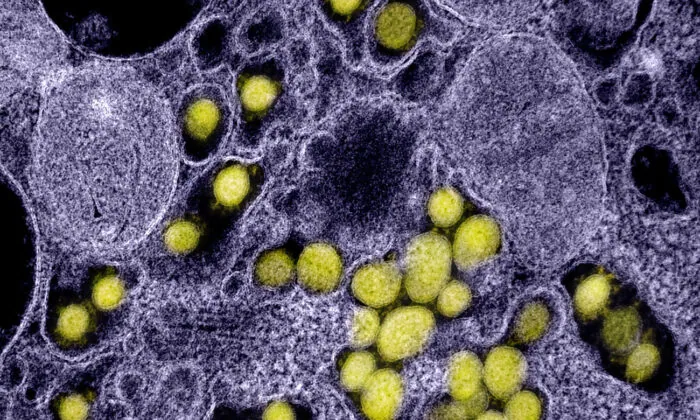 Decades-Old Drug May Help Protect Against Severe COVID-19 Symptoms: Study