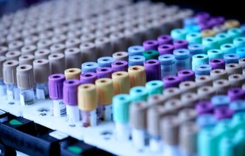 Revolutionary Blood Test Can Detect Over 50 Genetic Neurological Diseases: 'Will be a Game-Changer'